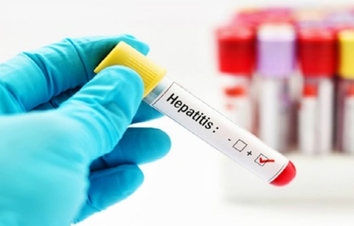 hepatitis E